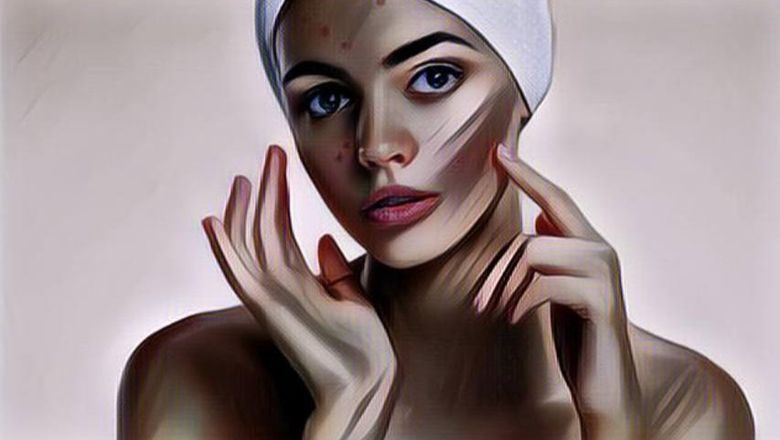 Berhenti Konsumsi Susu Bisa Mengatasi Jerawat, Apa Benar?