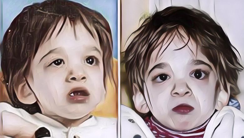 Kisah Brooke Greenberg, Gadis 20 Tahun yang Terjebak Dalam Tubuh Bayi 2 Tahun