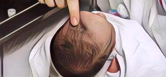 Ubun Ubun Bayi Cekung, Jangan Dulu Panik Moms, Begini Penjelasannya ....