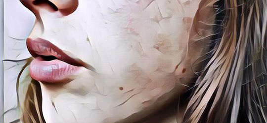 Kenapa Wajah Bisa Bruntusan? Ternyata Ini yang Terjadi pada Kulitmu!