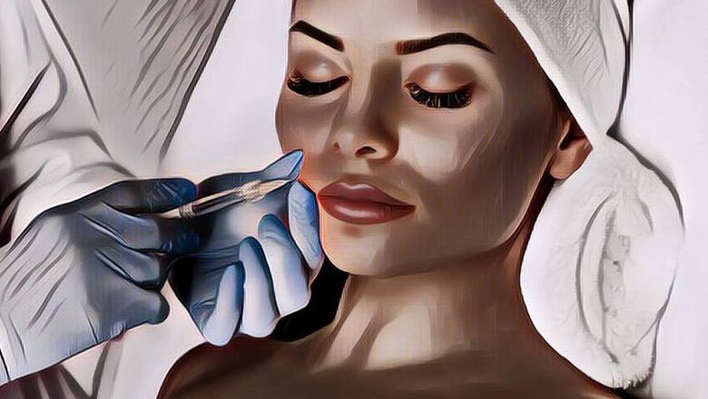 Ingin Lakukan Facial Fillers dengan Cara Alami? Coba Tren E-Shape Ini!