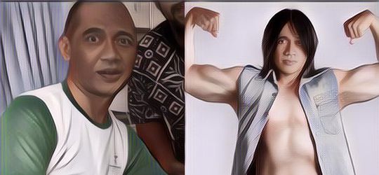 Sebelum Ruben Onsu, 5 Artis yang Punya Masalah Kesehatan Pada Otak