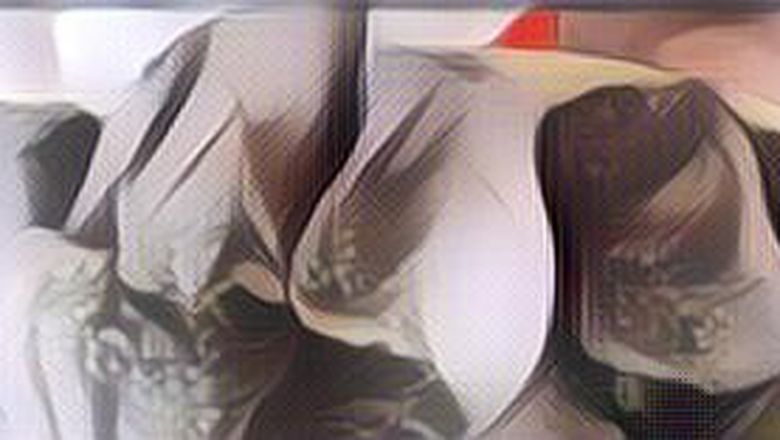 Deretan Makanan Beracun yang Diolah di Indonesia