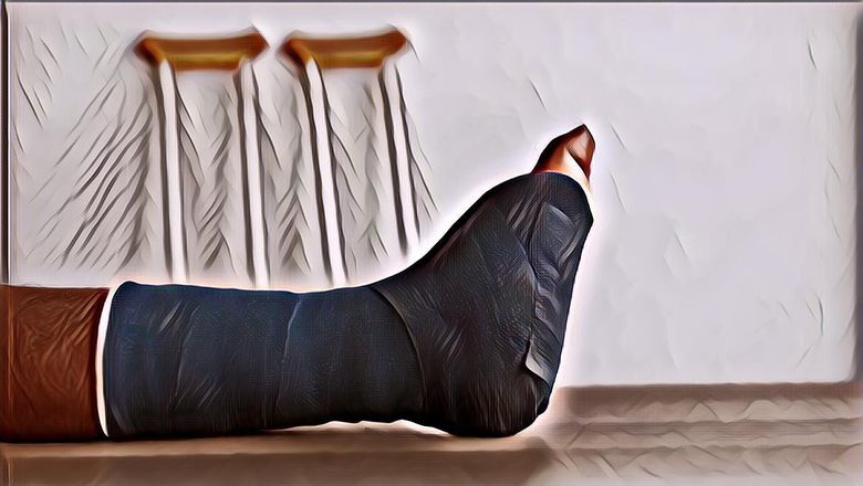 Berapa Lama Waktu yang Dibutuhkan untuk Sembuh dari Patah Tulang?