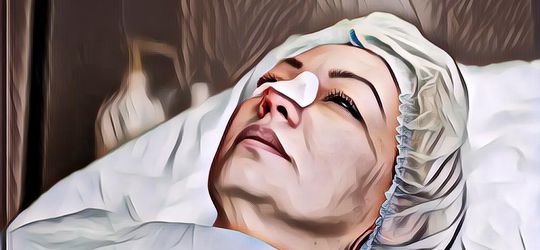 Berencana Operasi Hidung Agar Mancung? Kenali Dulu Prosedur dan Resikonya