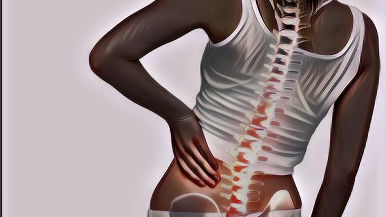 Penyebab Pengapuran Tulang Belakang, Gak Hanya Karena Usia Lanjut