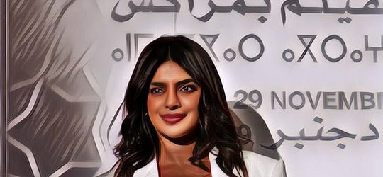 Operasi Plastik Priyanka Chopra Gagal, Hasilnya Mengerikan!