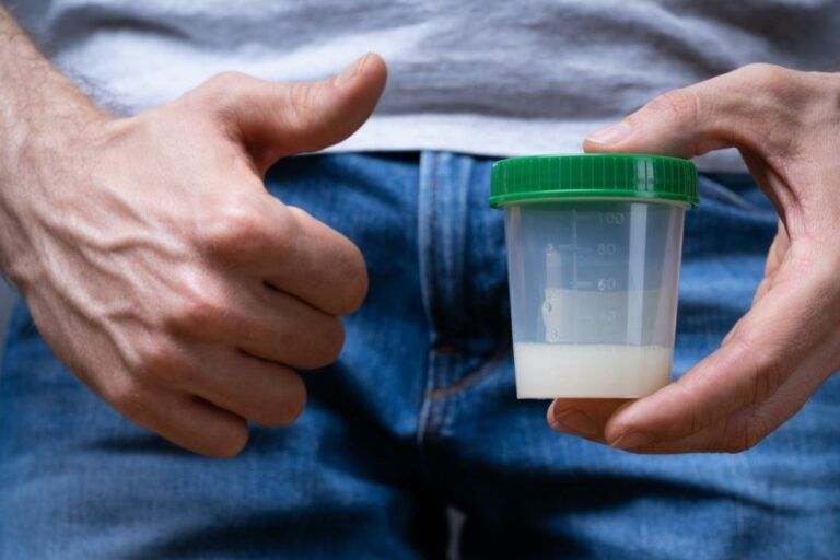 # Warna Sperma Kuning atau hijau