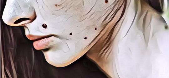 Enggak Perlu Operasi, Ini Lho Cara Menghilangkan Tahi Lalat Secara Alami