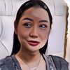 Lucinta Luna Ungkap Alasan Oplas Lagi, Ternyata Hidungnya Jebol