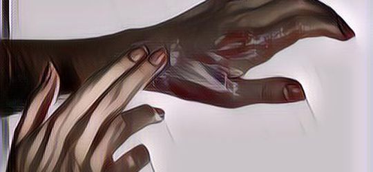 Sering Salah Kaprah, Ternyata Begini Tips Pertolongan Pertama Pada Luka Bakar Ringan