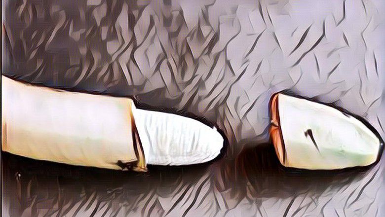 Usia Ideal Anak Laki-laki Sunat Menurut Pandangan Medis