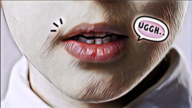 Puasa Bikin Bibir Kering dan Pecah-Pecah? Kenali Juga 7 Penyebab Lainnya