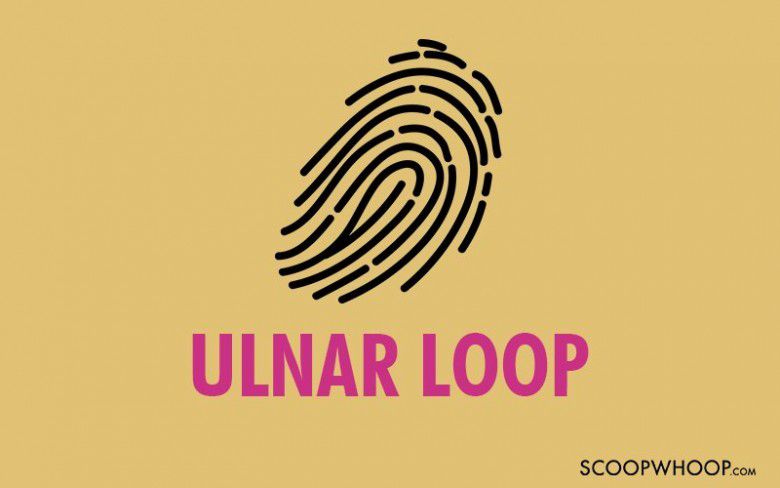 3. Ulnar Loops