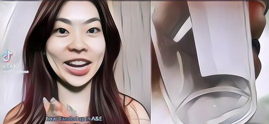 Apes! Gini Kronologi Wanita Sampai Harus Operasi Gegara Tauge Tersangkut Di Tenggorokannya