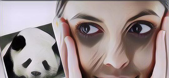 Fakta Mengenai Mata Panda dan Cara Alami untuk Mengatasinya