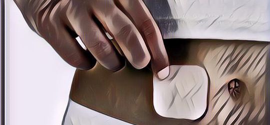 Alat Kontrasepsi Koyo KB Sempat Viral, Bagaimana dengan Tingkat Keamanannya?