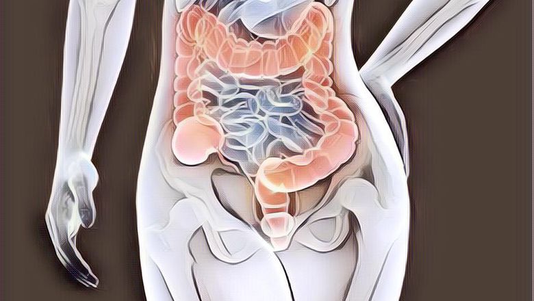 Terhindar dari Kanker Usus dengan 5 Cara Mudah Membersihkan Usus Besar Ini!