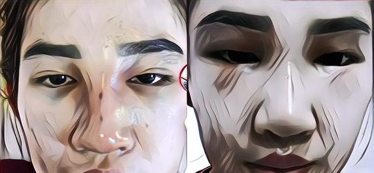 Mencoba Lawan Takdir Dengan Operasi Plastik Demi Mirip Aktris Korea, Wajah Wanita Ini Bikin Kaget