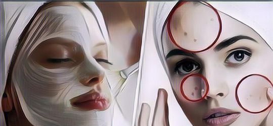 Cara Menghilangkan Flek Hitam di Wajah, Cukup dari Bahan Alami Rumahan