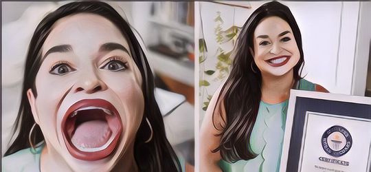 Bikin Terkejut, Wanita Ini Punya Bibir Terbesar di Dunia, Begini Penampilannya