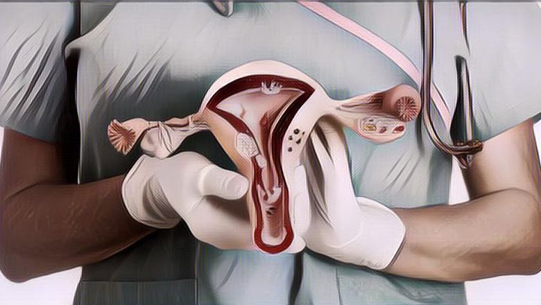 Kenali Gejala Kista Ovarium, Penyakit yang Sempat Diderita Aurel Hermansyah