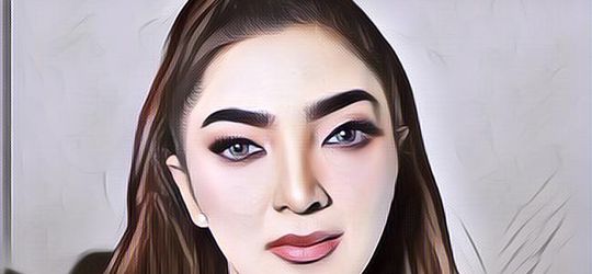 Kebiasaan Buruk Ashanty yang Membuatnya Mengidap Autoimun