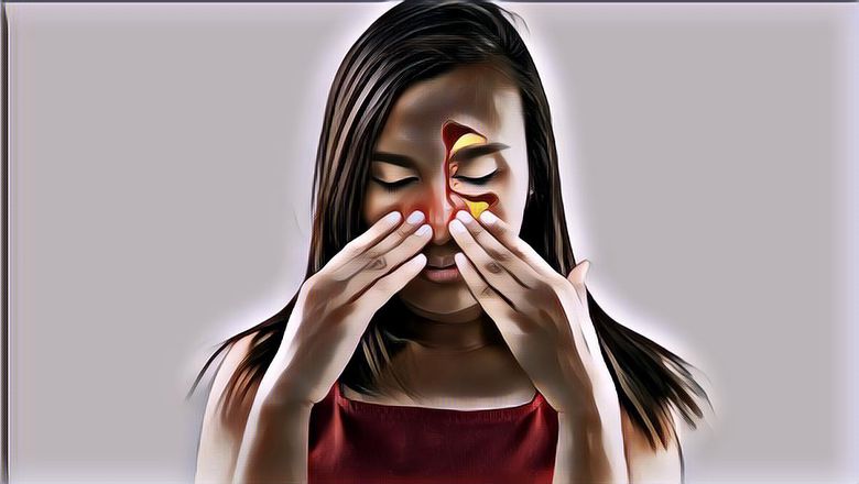 Cara Atasi Hidung Tersumbat Karena Sinusitis dengan Pijatan, Demi Napas Plong!