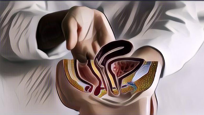 Penyebab dan Cara Mencegah Infeksi Saluran Kencing pada Pria