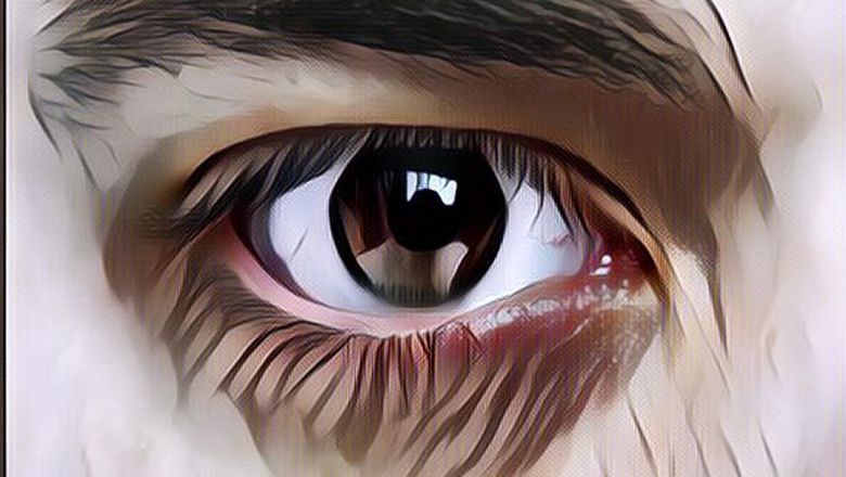 Fluktuasi Hormon Saat Monopouse Bisa Picu Mata Kering, Begini Penjelasan Ahli