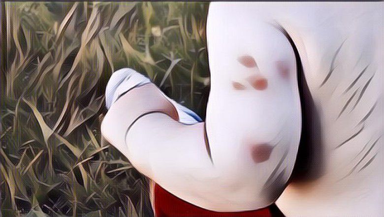 Cara Menghilangkan Bekas Gigitan Nyamuk pada Bayi: Nggak Perlu Panik Lagi Moms