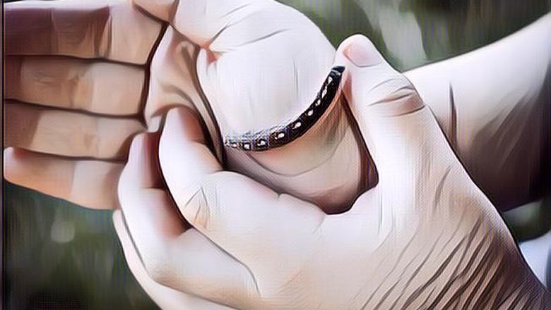 Tips Jitu Atasi Gatal Akibat Ulat Bulu, Gak Boleh Digaruk!