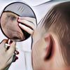 Tips dan Trik Menyuburkan Rambut Agar Lebat dan Kuat