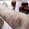 Ini Dia 8 Makanan Paling Umum Penyebab Alergi yang Kamu Wajib Hindari