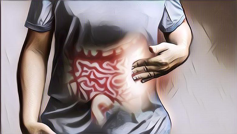 Dokter Spesialis Penyakit Dalam Sebut Peradangan Usus Bisa Sembuh Total dengan Perawatan Secara Rutin