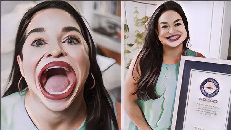 Bikin Terkejut, Wanita Ini Punya Bibir Terbesar di Dunia, Begini Penampilannya