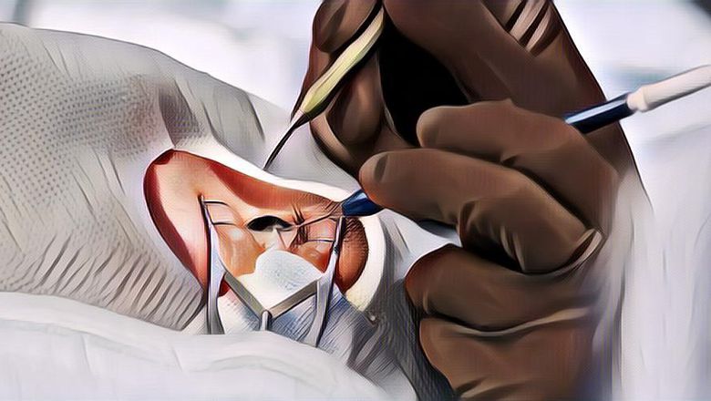 Kisah Dokter yang Lakukan Transplantasi Mata Pertama Kalinya di Dunia