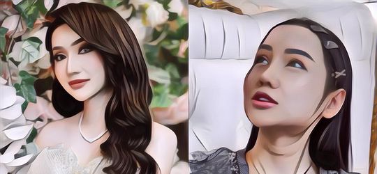 Buka Topeng, Lucinta Luna Akhirnya Ungkap Wajah Hasil Operasi Plastik, Tapi Bagian Ini Masih Bikin Penasaran