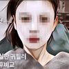 Orang Korea Sedang Tren Lakukan Filler 'Aneh' Ini, Terinspirasi dari Haerin Newjeans