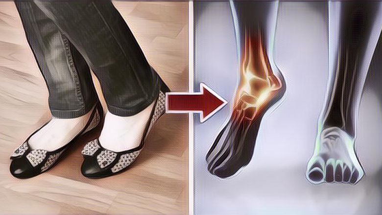 3 Jenis Sepatu Wanita yang Bisa Berpengaruh Buruk Untuk Kesehatan, Hati-Hati Girls