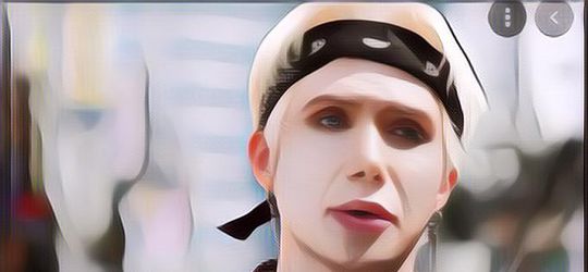 Terobsesi Jadi Orang Korea, Bule Ini Rela Operasi Mata Supaya Terlihat Sipit