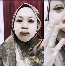 Viral Wanita Bibirnya Mendadak Bengkak 3 Jam Sebelum Akad Nikah! Begini Kondisinya