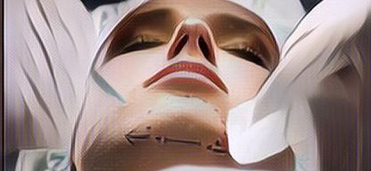 Seorang Wanita Depresi Usai Dagunya Alami Infeksi Parah Pasca Operasi