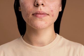 Bagaimana Mengatasinya?