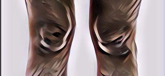 Bekas Luka Hilang Sekejap dengan Memakai 9 Obat Ini, Kulit Kembali Mulus Percaya Diri Pun Kembali