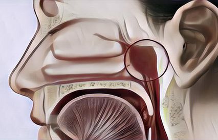 Mengenal Apa Itu Adenoid yang Sering Diderita Anak dengan Alergi, Apakah Bisa Sembuh Sendiri?