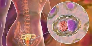 4. Penyakit Radang Panggul