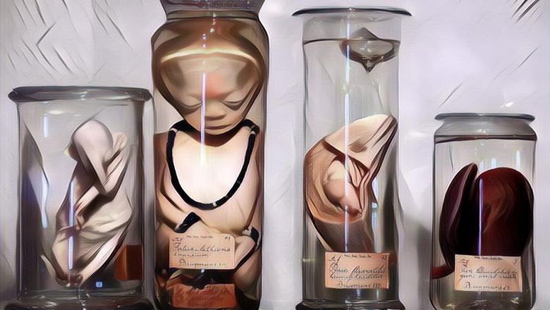 Dari Janin Cacat Sampai Pemakaman, Ini Daftar Museum Yang Punya Koleksi Unik, Nyeleneh, Sampai Mengerikan!