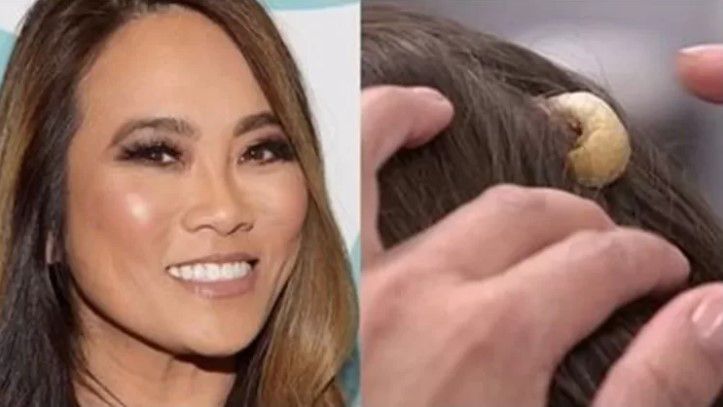 Awal tumbuhnya tanduk Lisa