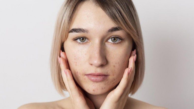 2. Kulit Nampak Kusam